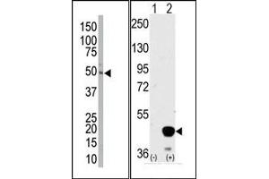 Image no. 2 for anti-Mitogen-Activated Protein Kinase Kinase 2 (MAP2K2) (Middle Region) antibody (ABIN360373) (MEK2 antibody  (Middle Region))