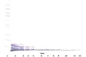 Image no. 1 for anti-Chemokine (C-X-C Motif) Ligand 6 (CXCL6) antibody (ABIN464968) (CXCL6 antibody)
