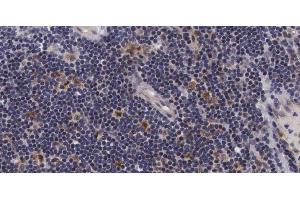 ABIN6267686 at 1/100 staining human Lymph node tissue sections by IHC-P. (ASK1 antibody  (pSer966))