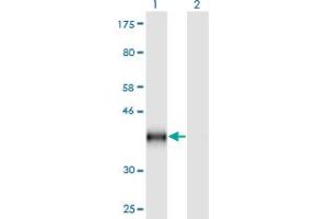 Western Blot analysis of CD59 expression in transfected 293T cell line by CD59 monoclonal antibody (M02), clone 3G6. (CD59 antibody  (AA 1-128))