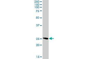 RAB32 MaxPab rabbit polyclonal antibody. (RAB32 antibody  (AA 1-225))
