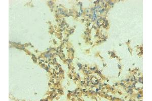 Immunohistochemical of paraffin-embedded human lung tissue using ABIN7168560 at dilution of 1:200 (S1A9 antibody)