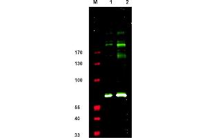 Western blot using anti-IRS1 pS307 antibody shows detection. (IRS1 antibody  (pSer307))