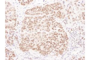 anti-Polymerase (DNA Directed), delta 1, Catalytic Subunit 125kDa (POLD1) (AA 50-100) antibody