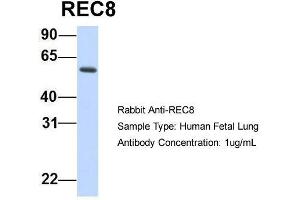 Host:  Rabbit  Target Name:  REC8  Sample Type:  Human Fetal Lung  Antibody Dilution:  1. (REC8 antibody  (N-Term))