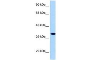 Image no. 1 for anti-Emerin (EMD) (AA 34-83) antibody (ABIN6748071) (Emerin antibody  (AA 34-83))