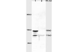 Lane 1: rat lung lysates Lane 2: rat brain lysates probed with Anti NOS-2/iNOS Polyclonal Antibody, Unconjugated (ABIN725675) at 1:200 in 4 °C. (NOS2 antibody)