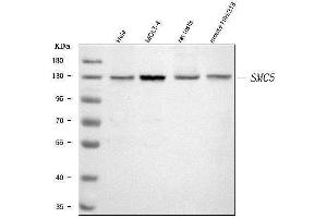 Western blot analysis of SMC5 using anti-SMC5 antibody (ABIN7600007).