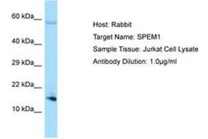SPEM1 Antikörper  (AA 72-121)