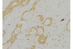 ABIN6277313 at 1/100 staining Human lung tissue by IHC-P. (Cathepsin E antibody  (Internal Region))