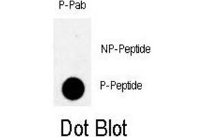 Dot Blot (DB) image for anti-Myelin Transcription Factor 1 (MYT1) (pThr495) antibody (ABIN3001766)