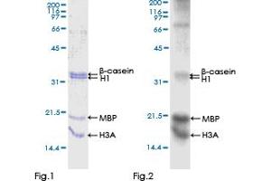 Western Blotting (WB) image for Cyclin-Dependent Kinase 18 (CDK18) (AA 1-472) protein (GST tag) (ABIN1314378)