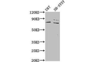 Western Blot Positive WB detected in: U87 whole cell lysate, SH-SY5Y whole cell lysate All lanes: TIPARP antibody at 4. (Tiparp antibody  (AA 74-178))