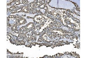 IHC analysis of P4HB using anti-P4HB antibody (ABIN7600075). (P4HB antibody  (AA 146-363))