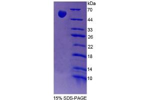 SDS-PAGE analysis of Rat FARS2 Protein. (FARS2 Protein)