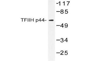 Western blot (WB) analysis of TFIIH p44 antibody in extracts from COLO205 (GTF2H2 antibody)
