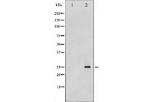 Western Blotting (WB) image for anti-Cyclin-Dependent Kinase Inhibitor 1A (p21, Cip1) (CDKN1A) (pThr145) antibody (ABIN6256478)