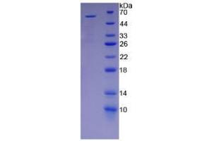 SDS-PAGE analysis of Human KIR2DS2 Protein.