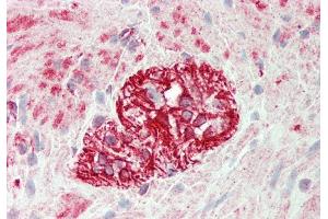 Rabbit Anti-KLHL25 antibody  Formalin Fixed Paraffin Embedded Tissue: Human Colon, Myenteric Plexus Primary antibody Concentration: 1:100 Secondary Antibody: Donkey anti-Rabbit-Cy3 Secondary Antibody Concentration: 1:200 Magnification: 20x Exposure Time: 0. (KLHL25 antibody  (N-Term))