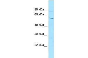 Host: Rabbit Target Name: 6720456H20Rik Sample Type: Mouse Testis lysates Antibody Dilution: 1. (C14orf101 antibody  (Middle Region))