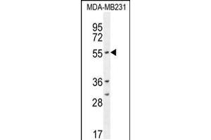 Western blot analysis in MDA-MB231 cell line lysates (35ug/lane). (CYP2A7 antibody  (AA 121-148))