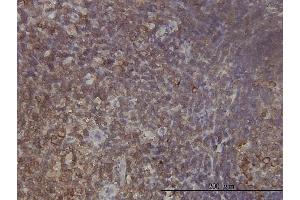 Immunoperoxidase of monoclonal antibody to RPL9 on formalin-fixed paraffin-embedded human tonsil tissue. (RPL9 antibody  (AA 93-191))