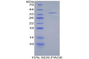 SDS-PAGE analysis of Human LFA1A Protein. (ITGAL Protein)