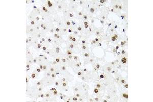 Immunohistochemistry of paraffin-embedded human liver injury using H2AFX antibody (ABIN4903860) at dilution of 1:100 (40x lens).