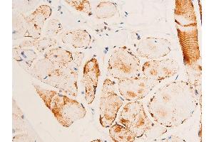 ABIN6267073 at 1/100 staining human heart tissue sections by IHC-P. (CHEK1 antibody  (pSer280))