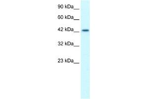 WB Suggested Anti-LHX3 Antibody Titration:  1. (LHX3 antibody  (Middle Region))