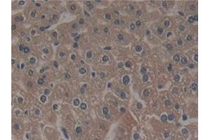 Detection of NCF4 in Mouse Liver Tissue using Polyclonal Antibody to Neutrophil Cytosolic Factor 4 (NCF4) (NCF4 antibody  (AA 111-339))