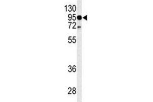 Western blot analysis of TLR4 antibody and HL-60 lysate. (TLR4 antibody  (AA 669-698))