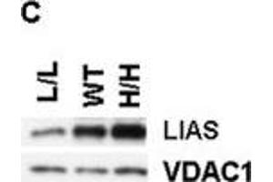 Characterizations of the new mouse model. (LIAS antibody)