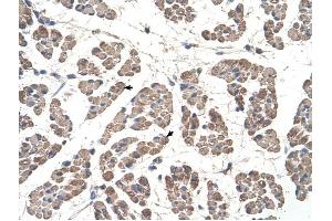 GCDH antibody was used for immunohistochemistry at a concentration of 4-8 ug/ml to stain Skeletal muscle cells (arrows) in Human Muscle.