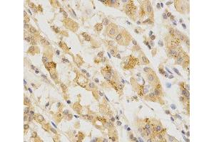 Immunohistochemistry of paraffin-embedded Human stomach using GGA2 Polyclonal Antibody at dilution of 1:200 (40x lens). (GGA2 antibody)