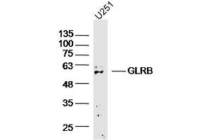 U251 cell lysates probed with GLRB Polyclonal Antibody, Unconjugated (bs-20450R) at 1:300 overnight at 4˚C. (GLRB antibody  (AA 51-150))