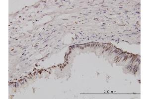 Immunostaining (ISt) image for anti-CSE1 Chromosome Segregation 1-Like (CSE1L) (AA 872-971) antibody (ABIN560494)