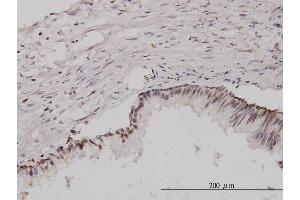 Immunoperoxidase of monoclonal antibody to CSE1L on formalin-fixed paraffin-embedded human prostate. (Exportin 2 antibody  (AA 872-971))