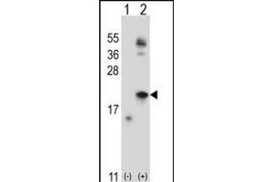 Western blot analysis of IL21 (arrow) using rabbit polyclonal IL21 Antibody (C-term) (ABIN657761 and ABIN2846740). (IL-21 antibody  (C-Term))