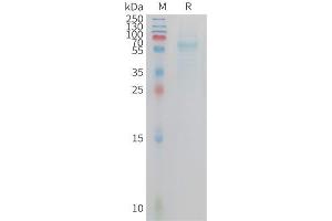Cynomolgus T Protein, hFc Tag on SDS-PAGE under reducing condition.