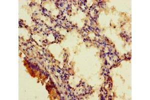 Immunohistochemistry of paraffin-embedded human lung tissue using ABIN7167709 at dilution of 1:100