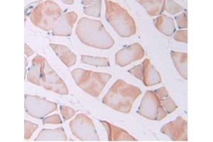 Immunohistochemistry (Paraffin-embedded Sections) (IHC (p)) image for anti-Interleukin 6 (IL6) (AA 21-211) antibody (ABIN6002527)