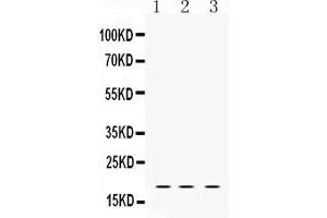 Western blot analysis of LMO1 expression in rat brain extract ( Lane 1), NIH3T3 whole cell lysates ( Lane 2) and HELA whole cell lysates ( Lane 3). (LMO1 antibody  (C-Term))