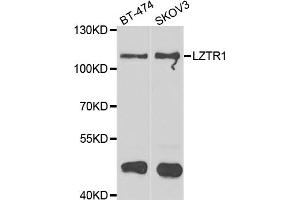 Western blot analysis of extracts of various cell lines, using LZTR1 antibody (ABIN4904276) at 1:1000 dilution. (LZTR1 antibody)