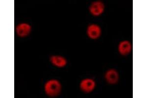 ABIN6276536 staining HepG2? (CTCF antibody  (C-Term))