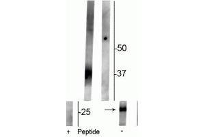 Western blot of rat kidney lysate showing specific immunolabeling of the ~29 kDa and 37 kDa glycosylated form of the AQP2 protein phosphorylated at Ser261 in the first lane (-). (AQP2 antibody  (pSer261))