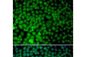 Immunofluorescence analysis of MCF-7 cells using RBX1 Polyclonal Antibody