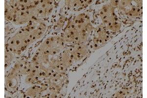 ABIN6275419 at 1/100 staining Human kidney tissue by IHC-P. (S100A3 antibody  (Internal Region))