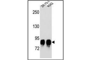 Western blot analysis of POMT1 Antibody (C-term) in ZR-75-1,K562 cell line lysates (35ug/lane).