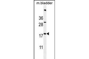 ACN9 Antibody (N-term) (ABIN655002 and ABIN2844636) western blot analysis in mouse bladder tissue lysates (35 μg/lane). (ACN9 antibody  (N-Term))